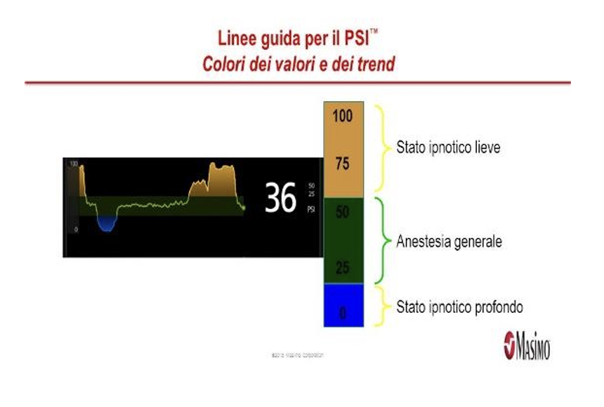 Screenshot-2024-11-21-alle-06.39.12 Management Infermieristico nella Gestione del Monitoraggio della Sedazione Profonda tramite Masimo SedLine.